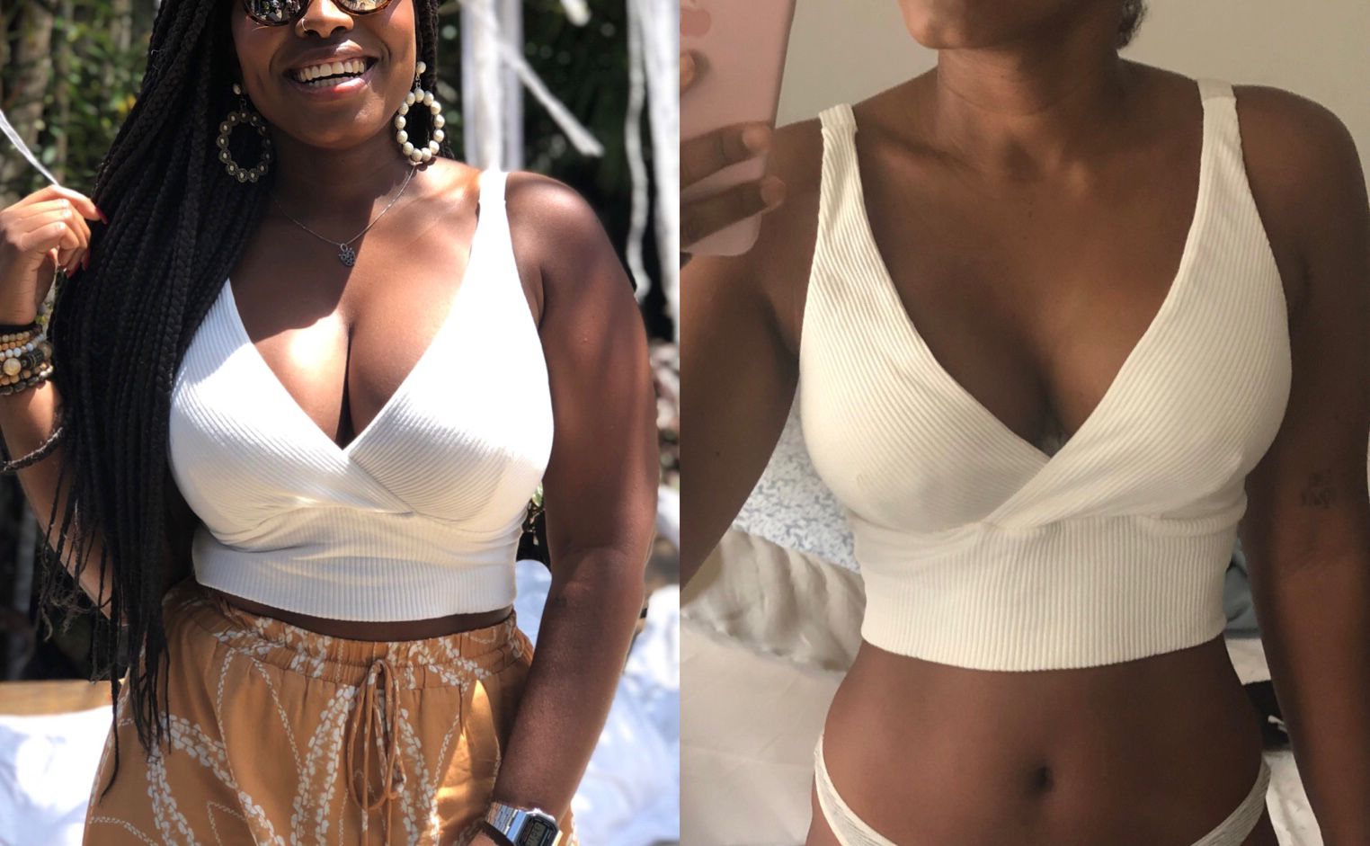 Side view of breast reduction results with internal bra support Bogota